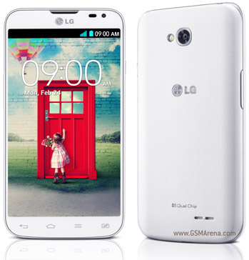 LG L70