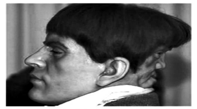 Edward Mordake