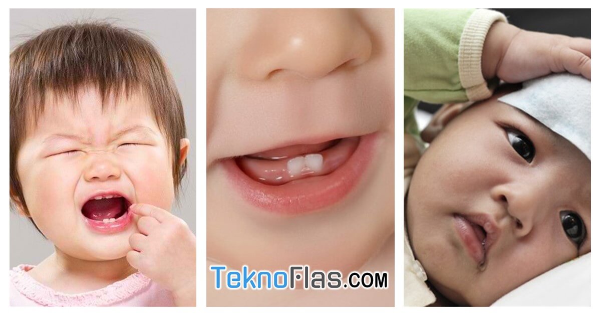 Begini Cara Mengatasi Demam Bayi Tumbuh Gigi